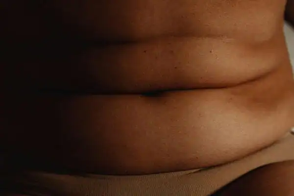 The Hidden Connection: How Stress Shapes Your Fitness and Body Composition 3 image of what stress can do on the stomach area and how Lipo 360 Sutton Coldfield can help to change your body shape.